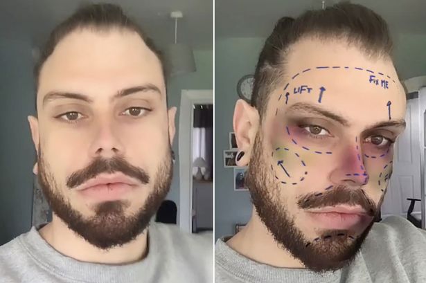 Instagram is set to remove all plastic surgery filters
