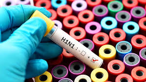 There’s no H1N1 epidemic; says Chief Medical Officer