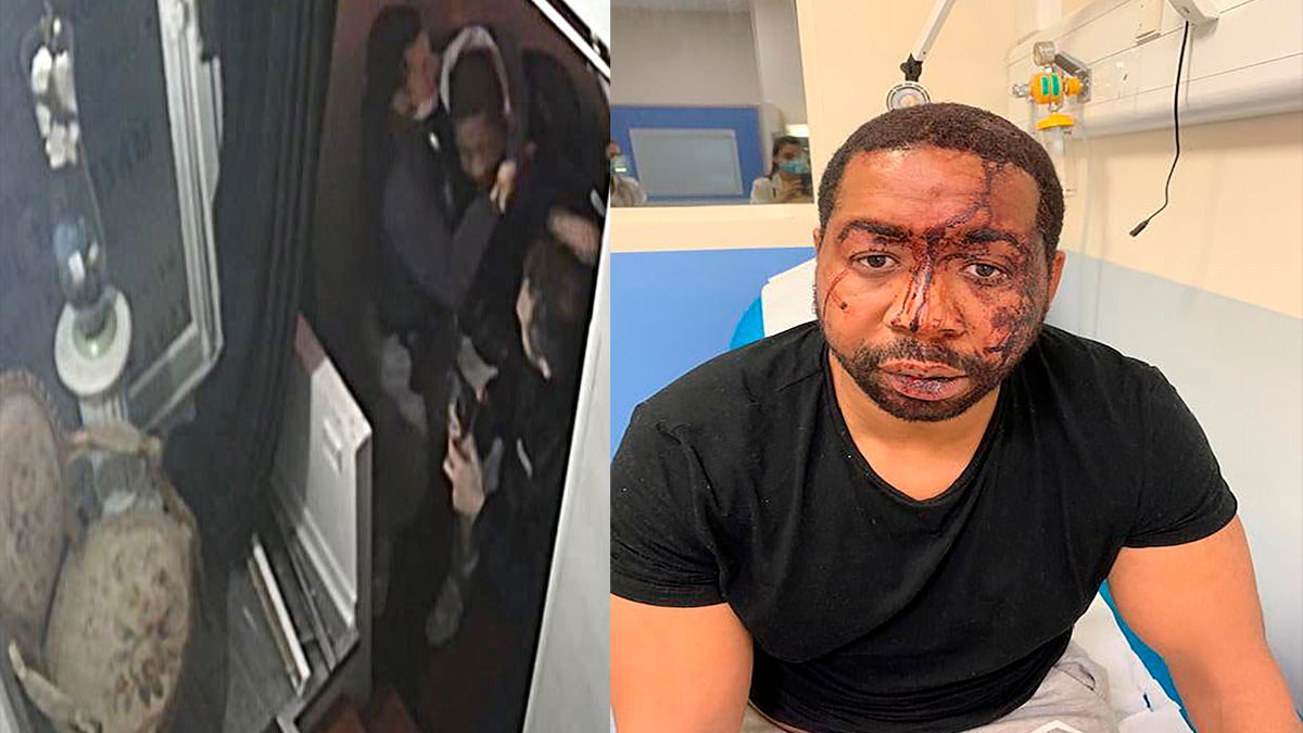France, Shocked by the Brutal Police Beating of a Black Man