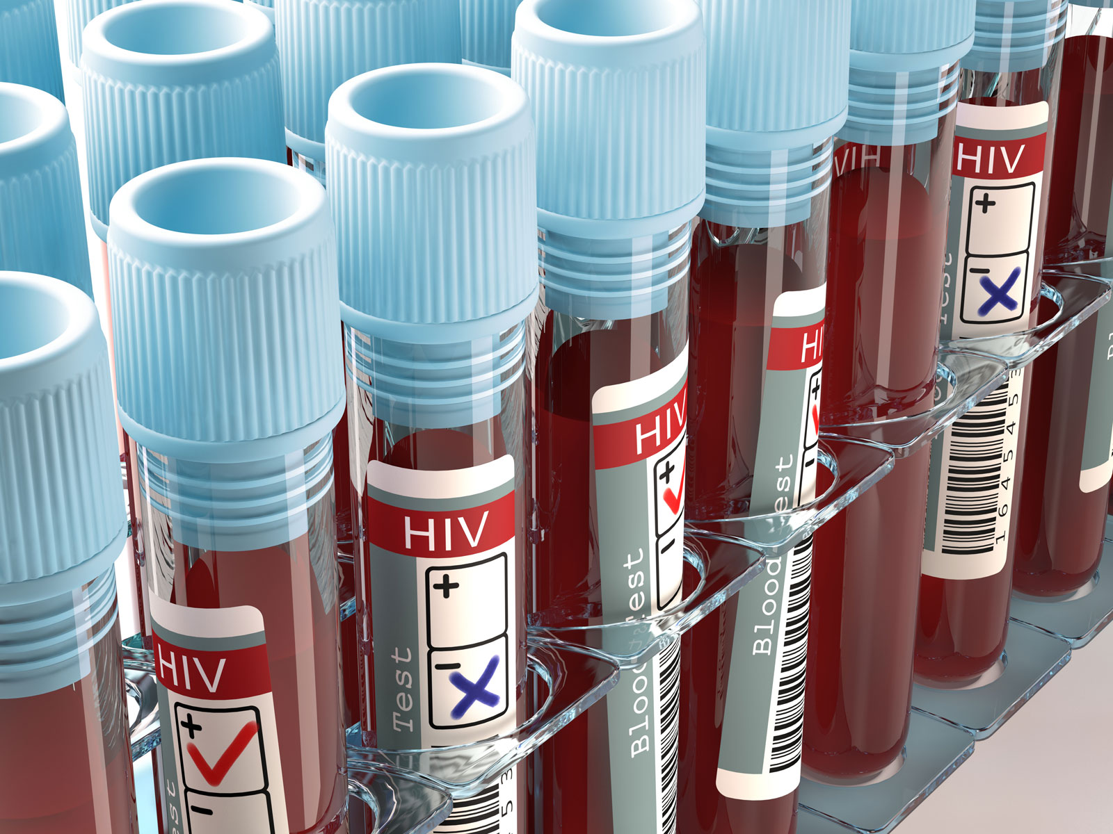 HIV Diagnosed Cases Fall Almost 30% in 2019