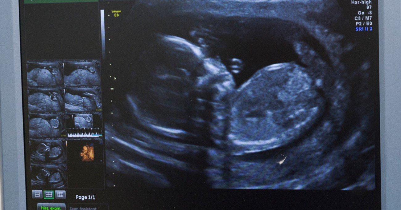 First Album Recorded by an Unborn Baby to be Released