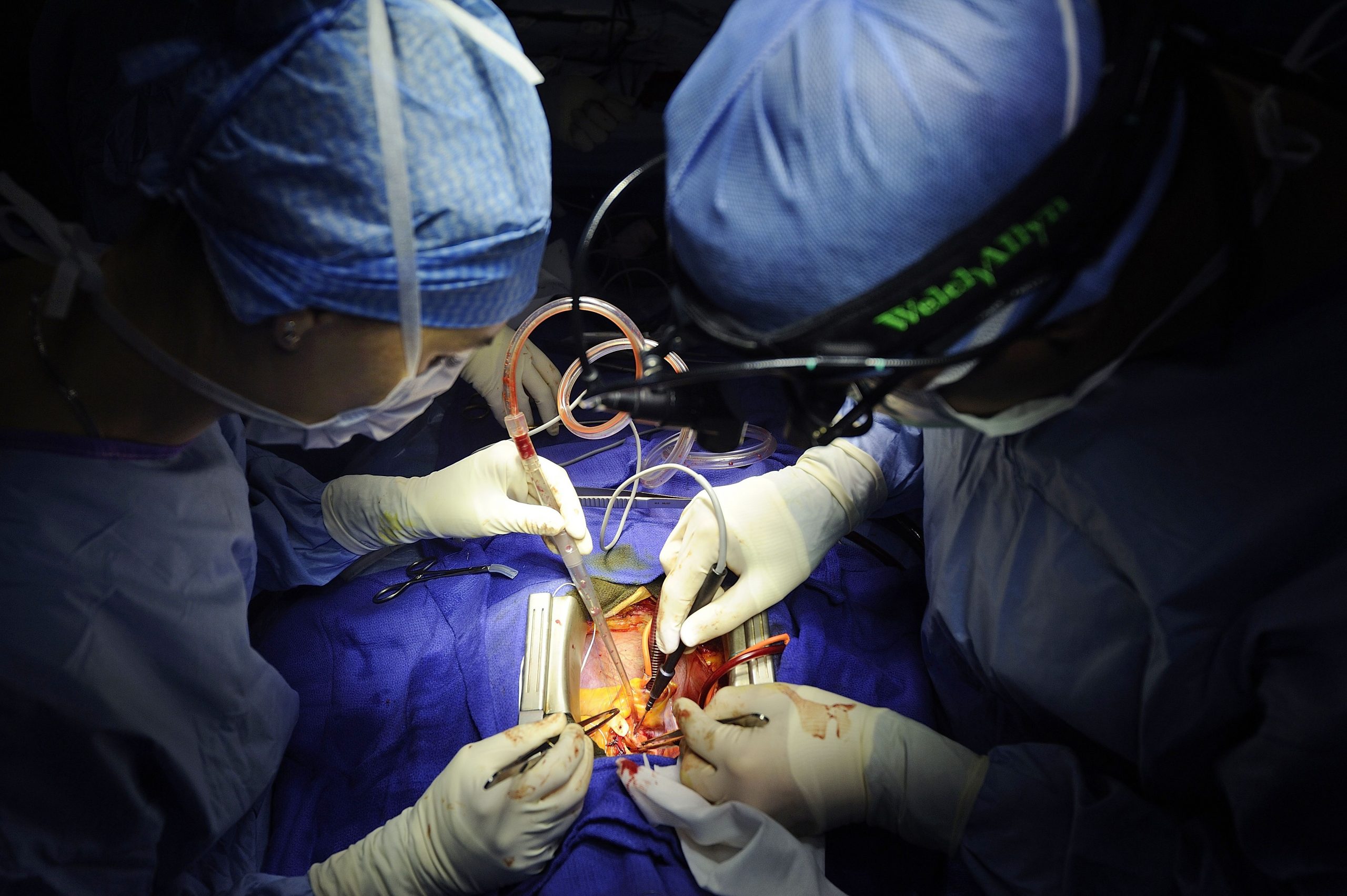 NCRHA doctors perform major heart procedure during covid-19 pandemic