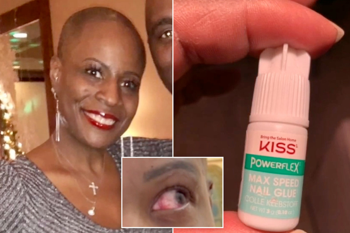Woman Glues Eye Shut After Mistaking Nail Glue for Eye Drops
