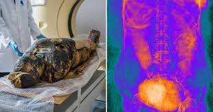 Egyptian Pregnant Mummy Discovered by Polish Researchers