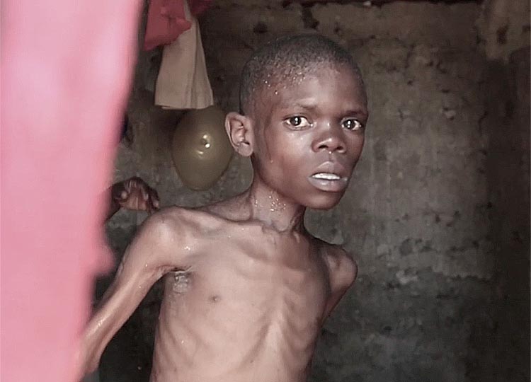 Haiti Faces Deadly Child Malnutrition Crisis in 2021