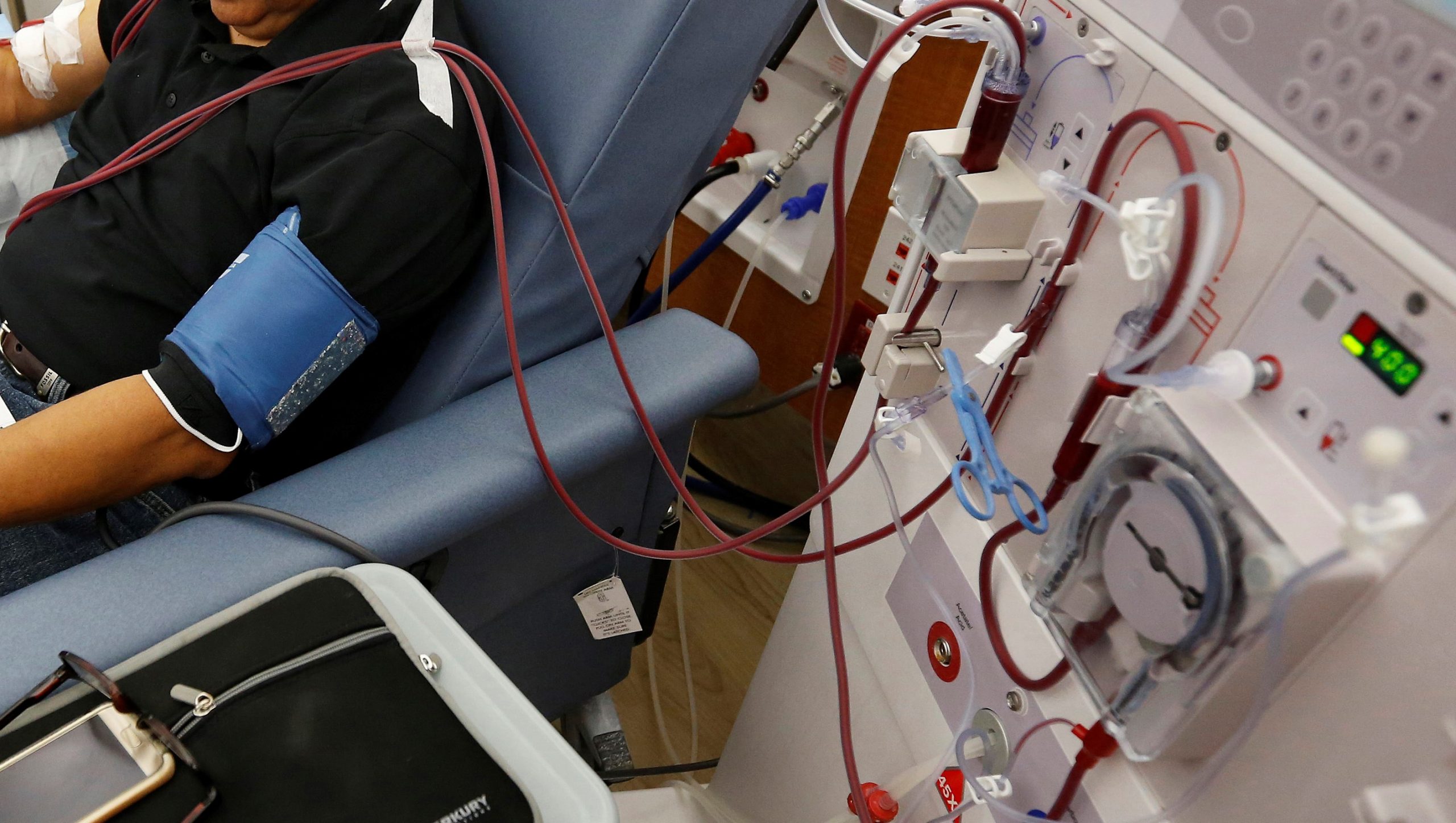 Mortality Rate Of Dialysis Patients, Due Covid-19, Is Described As Extremely Worrisome