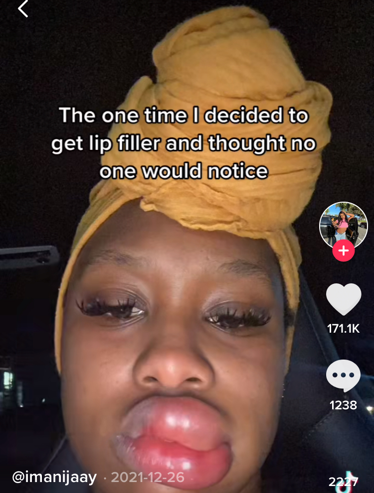 Woman reveals the aftermath of paying $15 for lip fillers on Tik Tok