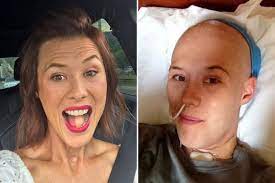 Woman lost her tongue to cancer got a new one made from her thigh – (it grew hair)