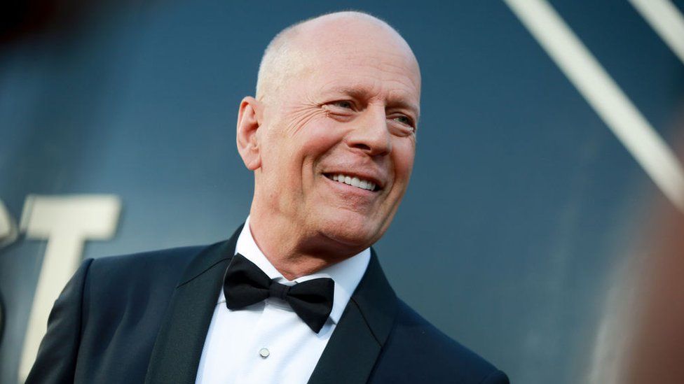 Bruce Willis’ family announces he has dementia