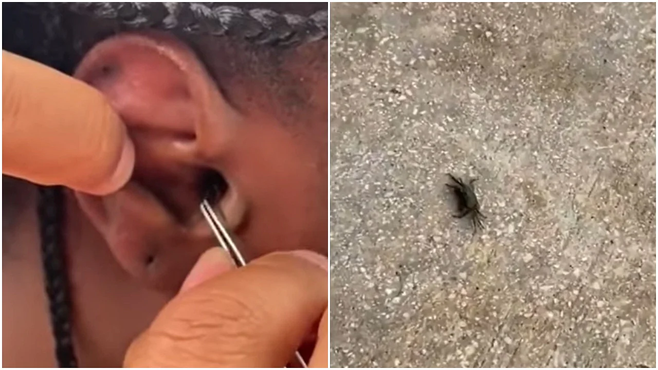 Crab gets stuck in woman’s ear after snokeling