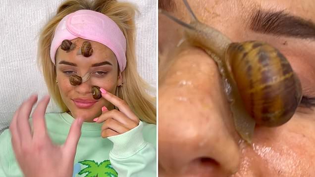 Woman uses snails on her face to help with scarring