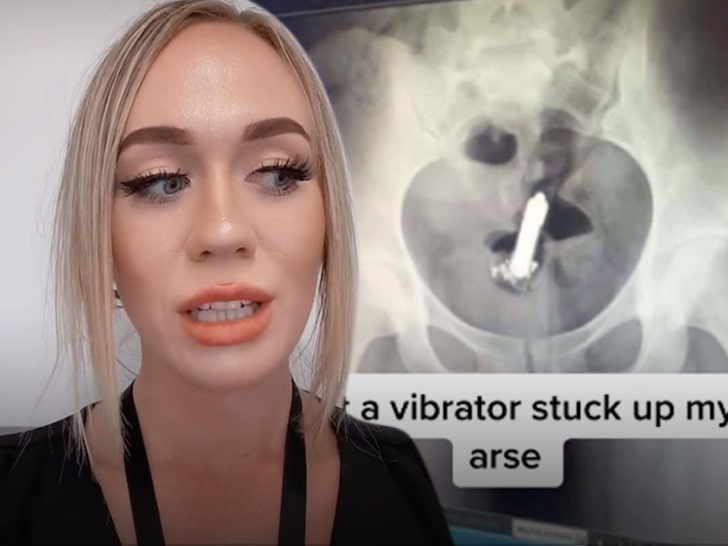 TikToker had surgery done to remove a sex toy from her butt
