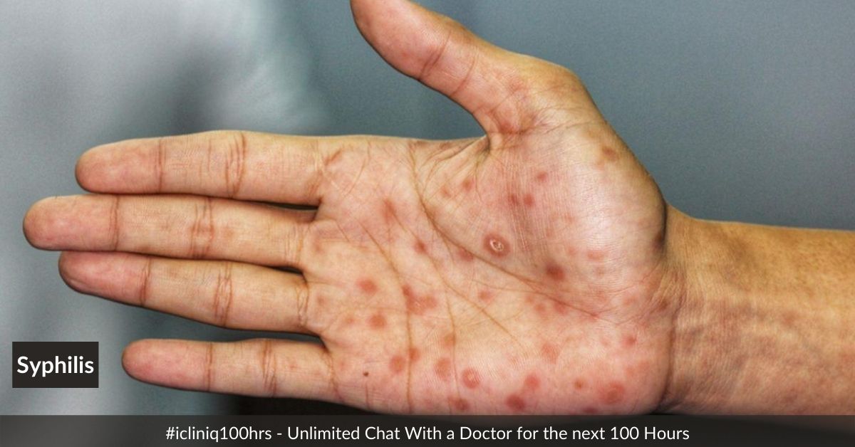 Jamaica records its first case of Monkeypox