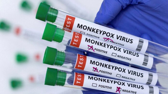 T&T continues to report zero monkeypox cases