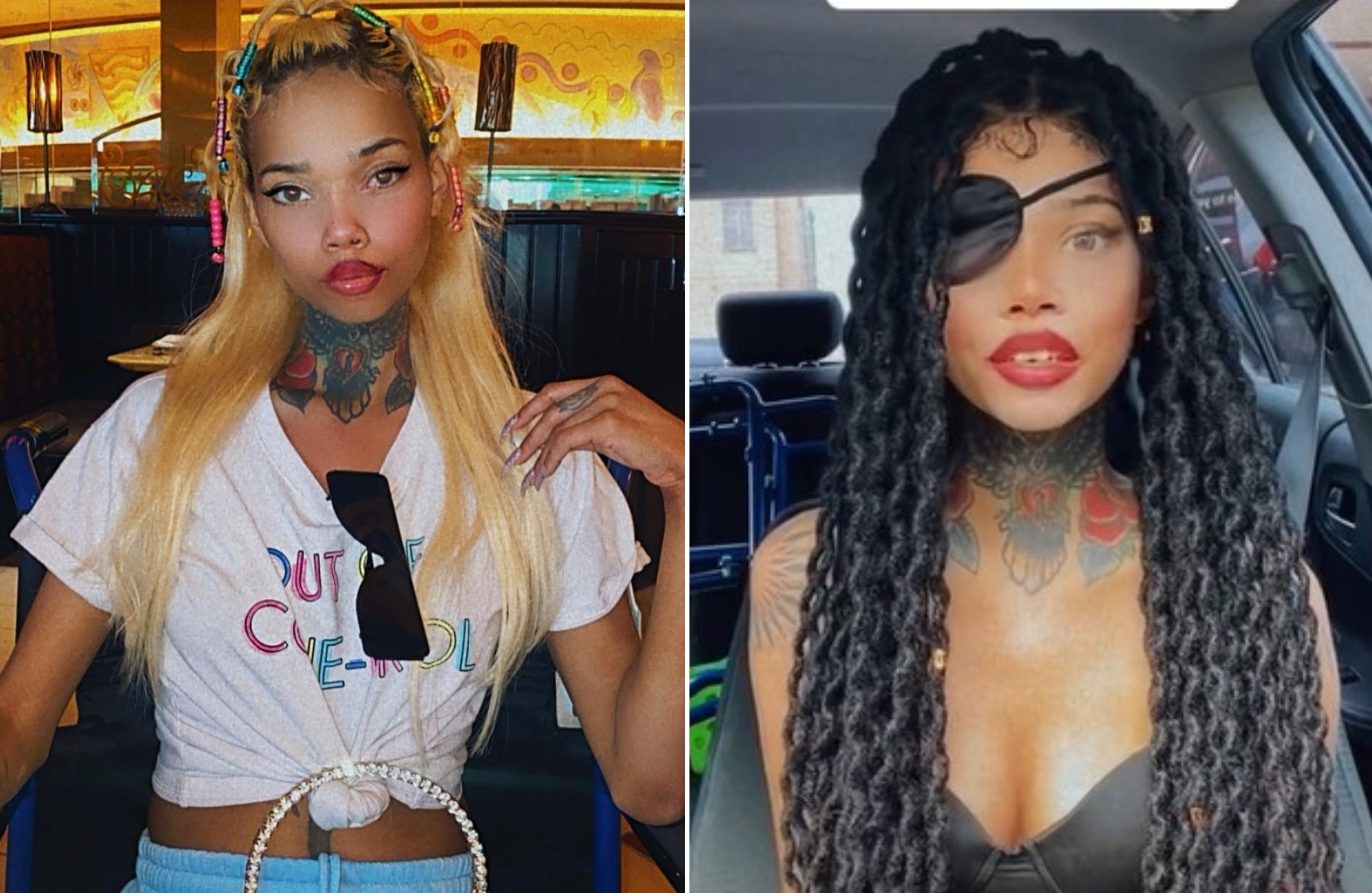 Instagram model reveals she is going blind after eye surgery following HIV diagnosis