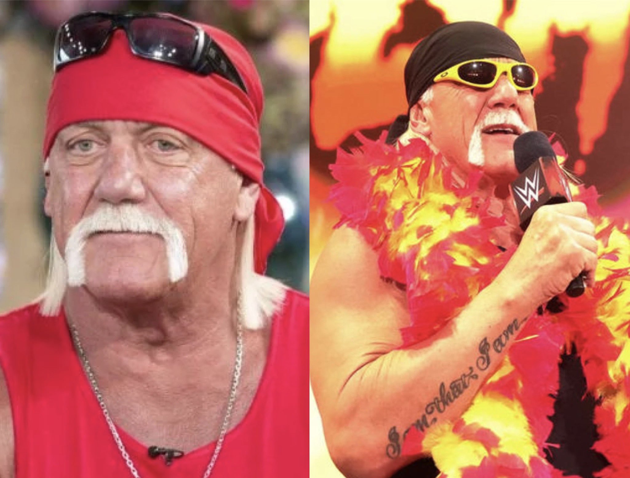 Hulk Hogan can’t feel his legs after back surgery gone wrong
