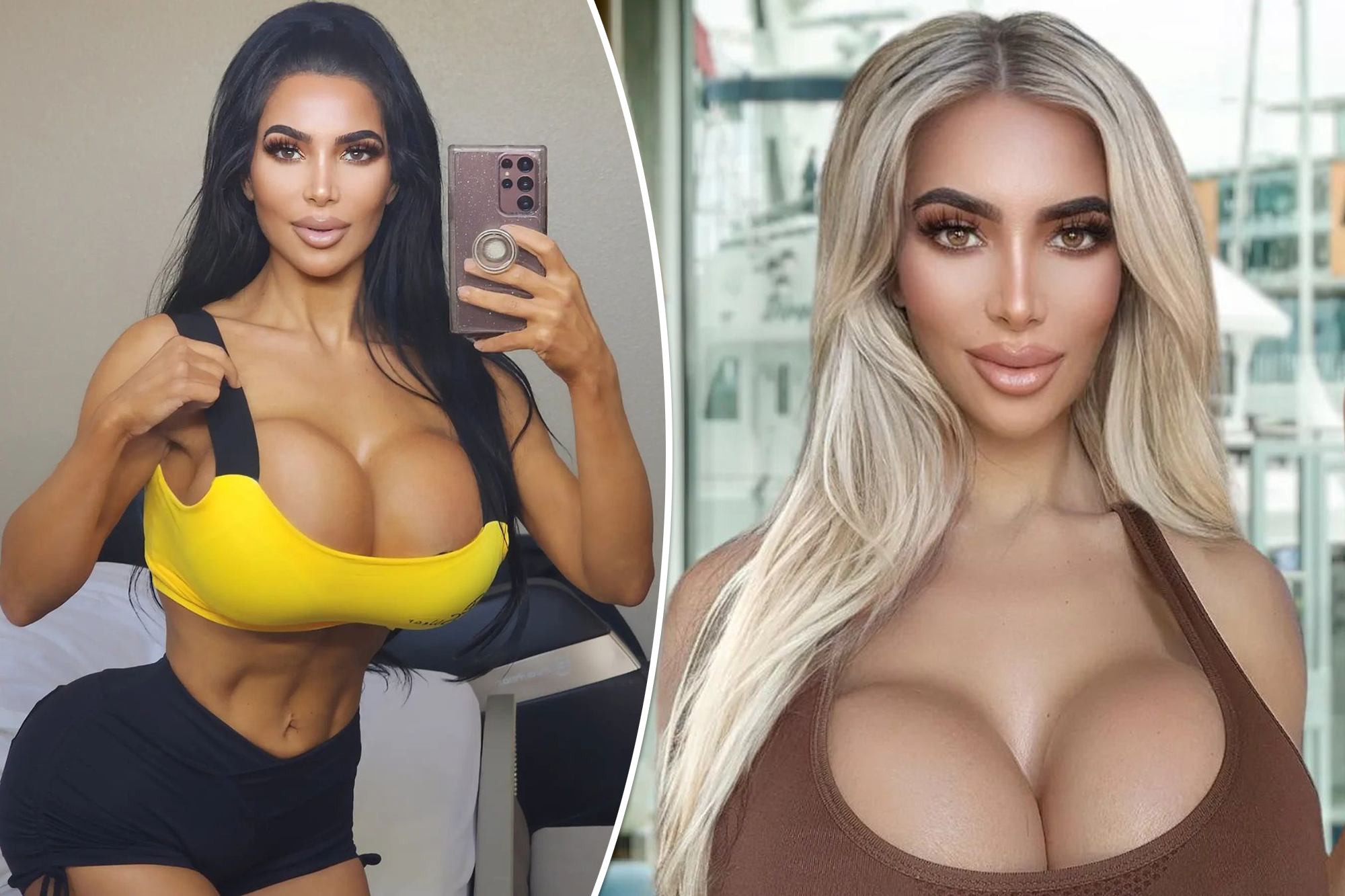 Woman charged in Kim Kardashian lookalike plastic surgery death