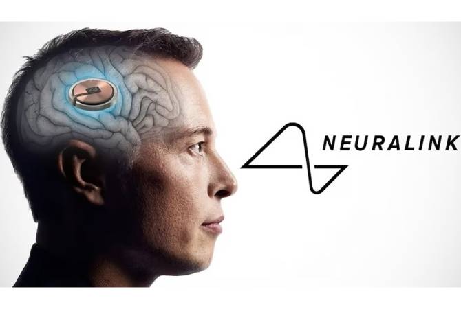 Elon Musk’s Neuralink received FDA approval for human brain study
