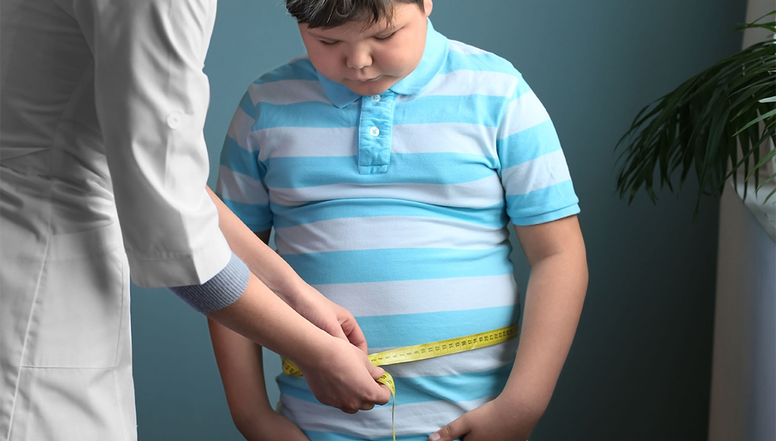 Rising number of obese children a serious concern says Paediatric Society