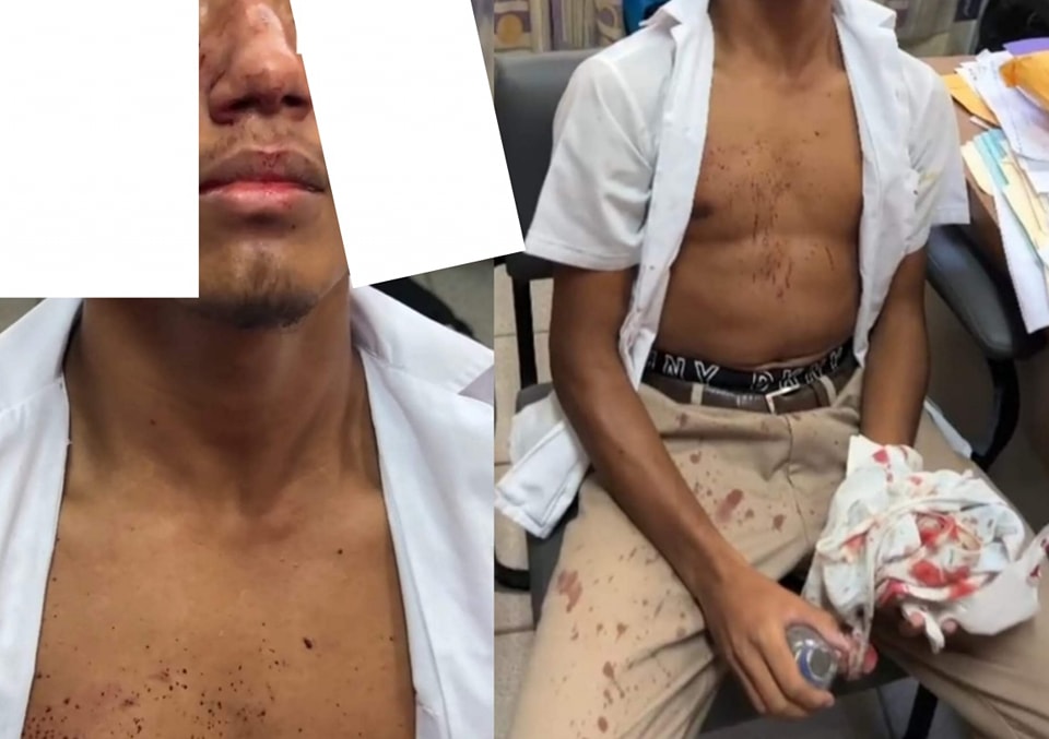 Schoolboy badly beaten by gang of ten