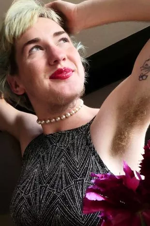 Woman who spent £51k removing body hair now proudly flaunts a beard